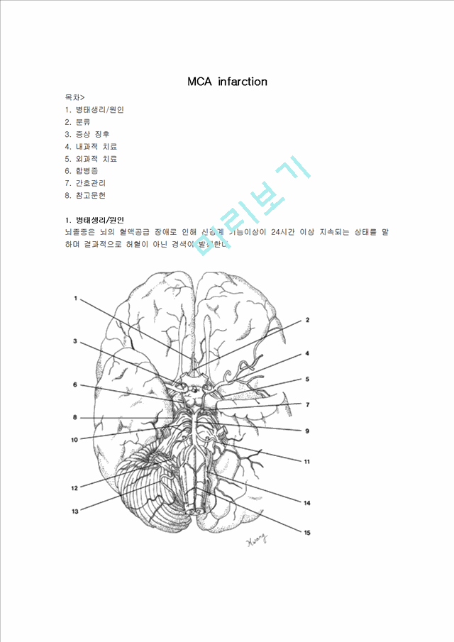 MCA infarction   (1 )